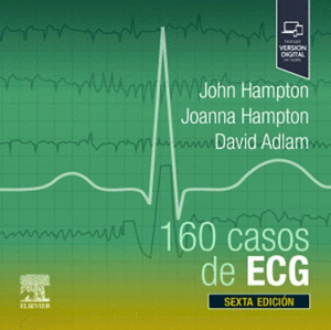 160 CASOS DE ECG