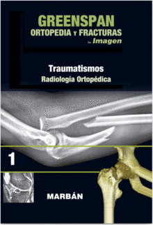 GREENSPAN. ORTOPEDIA Y FRACTURAS. VOL 1