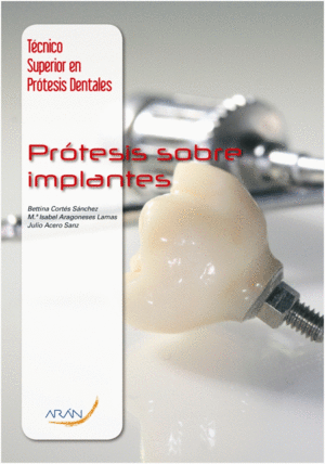 PR�TESIS SOBRE IMPLANTES