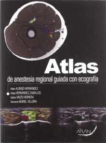 ATLAS DE ANESTESIA REGIONAL GUIADA CON ECOGRAFA