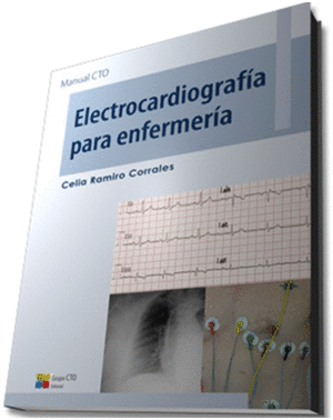 ELECTROCARDIOGRAFIA PARA ENFERMERIA. MANUAL CTO