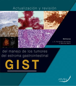 ACTUALIZACION Y REVISION DEL MANEJO DE LOS TUMORES DEL ESTROMA GASTROINTESTINAL GIST