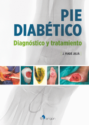 PIE DIABTICO. DIAGNSTICO Y TRATAMIENTO