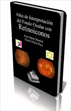 ATLAS DE INTERPRETACIN DEL FONDO OCULAR CON RETINOICONOS