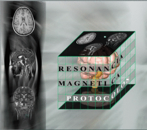 RESONANCIA MAGN�TICA, LOS PROTOCOLOS Y SU PR�CTICA.