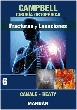 CAMPBELL CIRUGIA ORTOPEDICA . FRACTURAS Y LUXACIONES VOL. 6
