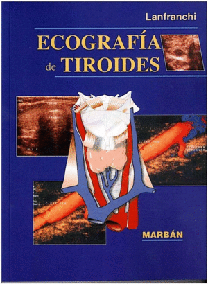 ECOGRAFÍA DE TIROIDES