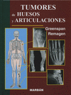 TUMORES DE HUESOS Y ARTICULACIONES
