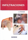 INFILTRACIONES