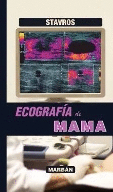 ECOGRAF�A DE MAMA