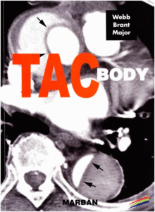 FUNDAMENTOS DE TAC BODY. FORMATO 