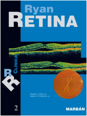 RETINA 2