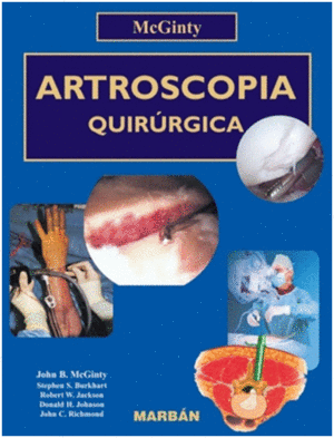 ARTROSCOPIA QUIR�RGICA. FLEXILIBRO