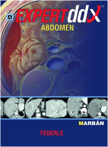ABDOMEN
