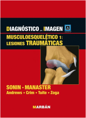 DIAGN�STICO POR IMAGEN. MUSCULOESQUEL�TICO 1: LESIONES TRAUM�TICAS