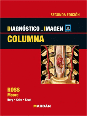 DIAGNOSTICO POR IMAGEN COLUMNA