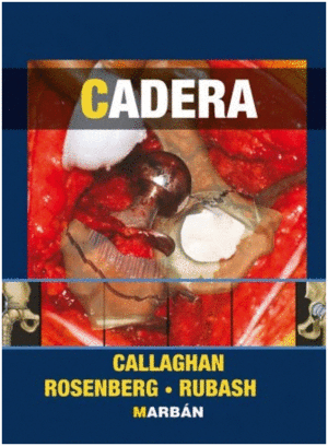 CALLAGHAN. CADERA. 3 VOLUMENES
