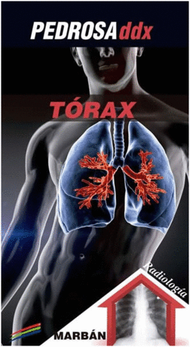 T�RAX. PEDROSA DDX