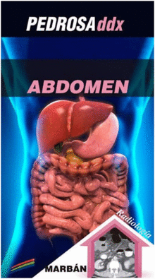 PEDROSA DDX: ABDOMEN