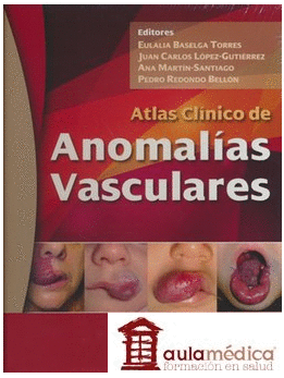 ATLAS CLINICO DE ANOMALIAS VASCULARES