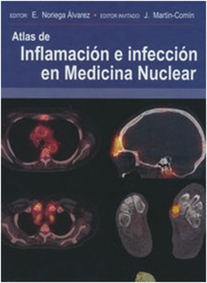 ATLAS DE INFLAMACIN E INFECCIN EN MEDICINA NUCLEAR