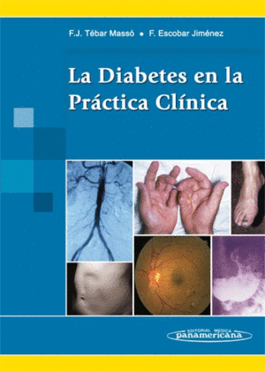 LA DIABETES EN LA PR�CTICA CL�NICA
