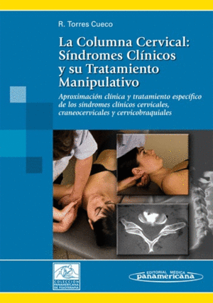 LA COLUMNA CERVICAL. TOMO 2 - S�NDROMES CL�NICOS Y SU TRATAMIENTO MANIPULATIVO