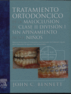 TRATAMIENTO ORTOD�NTICO DE LA MALOCLUSI�N DE CLASE II DIVISI�N 1 SIN API�AMIENTO EN LOS NI�OS