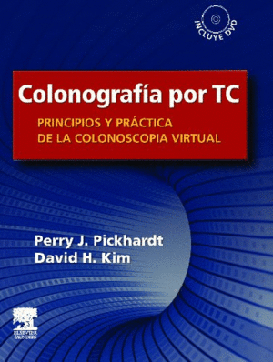 COLONOGRAFA POR TC : PRINCIPIOS Y PRCTICA DE LA COLONOSCOPIA VIRTUAL + DVD