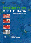 20 AÑOS DE REGENERACION OSEA GUIADA EN IMPLANTOLOGIA ORAL
