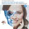 AJUSTE OCLUSAL EN IMPLANTES Y DIENTES NATURALES
