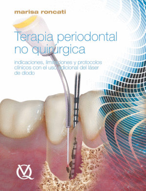 TERAPIA PERIODONTAL NO QUIRURGICA