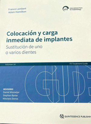 ITI TREATMENT GUIDE, VOL. 14: COLOCACIN Y CARGA INMEDIATA DE IMPLANTES. SUSTITUCIN DE UNO O VARIOS DIENTES