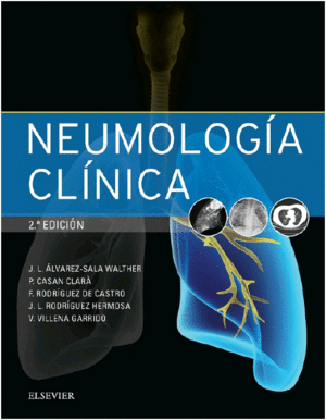 NEUMOLOG�A CL�NICA. 2� EDICI�N