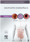 ESOFAGITIS EOSINOFLICA. CLNICAS IBEROAMERICANAS DE GASTROENTEROLOGA Y HEPATOLOGA