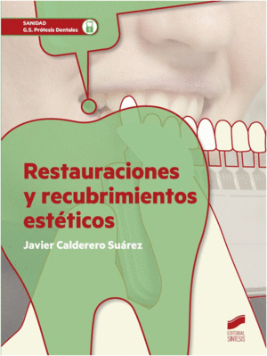 RESTAURACIONES Y RECUBRIMIENTOS ESTETICOS. CICLO FORMATIVO GRADO SUPERIOR PRTESIS DENTALES