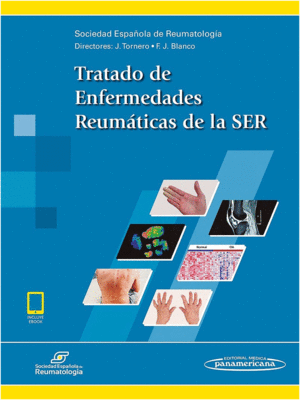 TRATADO DE ENFERMEDADES REUMÁTICAS DE LA SER (INCLUYE VERSIÓN DIGITAL).