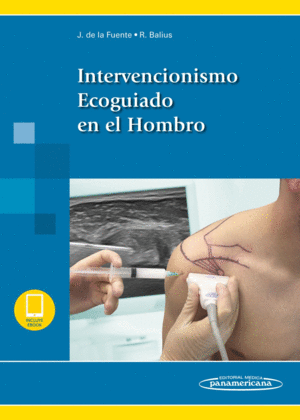 INTERVENCIONISMO ECOGUIADO EN EL HOMBRO (INCLUYE EBOOK)