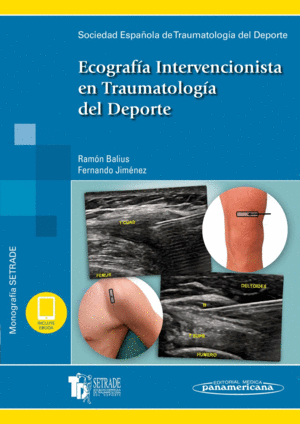 ECOGRAF�A INTERVENCIONISTA EN TRAUMATOLOG�A DEL DEPORTE (INCLUYE EBOOK). SETRADE SOCIEDAD ESPA�OLA DE TRAUMATOLOG�A DEL DEPORTE