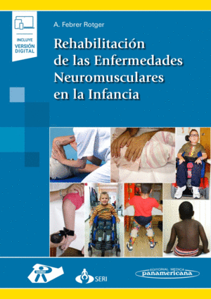 REHABILITACIÓN DE LAS ENFERMEDADES NEUROMUSCULARES EN LA INFANCIA (INCLUYE VERSIÓN DIGITAL).