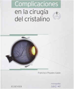 COMPLICACIONES EN LA CIRUGA DEL CRISTALINO + ACCESO WEB: MONOGRAFAS SECOIR