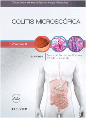COLITIS MICROSC�PICA. CL�NICAS IBEROAMERICANAS DE GASTROENTEROLOG�A Y HEPATOLOG�A VOL.9