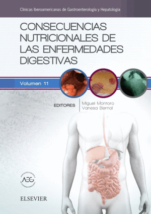 CONSECUENCIAS NUTRICIONALES DE LAS ENFERMEDADES DIGESTIVAS. CLÍNICAS IBEROAMERICANAS DE GASTROENTEROLOGÍA Y HEPATOLOGÍA VOL.11