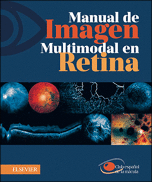 MANUAL DE IMAGEN MULTIMODAL EN RETINA