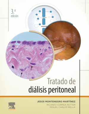 TRATADO DE DIÁLISIS PERITONEAL. 3ª EDICIÓN