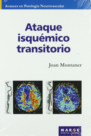ATAQUE ISQUEMICO TRANSITORIO (AVANCES EN PATOLOGIA NEUROVASCULAR, VOL. 5)