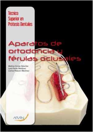 APARATOS DE ORTODONCIA Y F�RULAS OCLUSALES