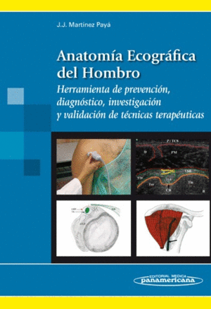 ANATOM�A ECOGR�FICA DEL HOMBRO. HERRAMIENTA DE PREVENCI�N, DIAGN�STICO, INVESTIGACI�N Y VALIDACI�N DE T�CNICAS TERAP�UTICAS