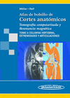 ATLAS DE BOLSILLO DE CORTES ANATOMICOS. TOMOGRAFIA COMPUTARIZADA Y RESONANCIA MAGNETICA.
