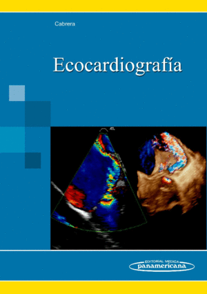 ECOCARDIOGRAFIA